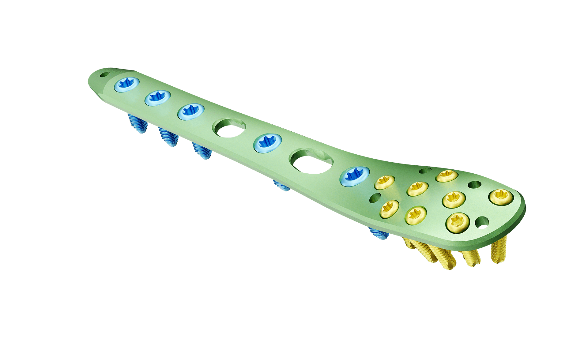 Distal Fibula Lateral Malleolar Anatomik Plak