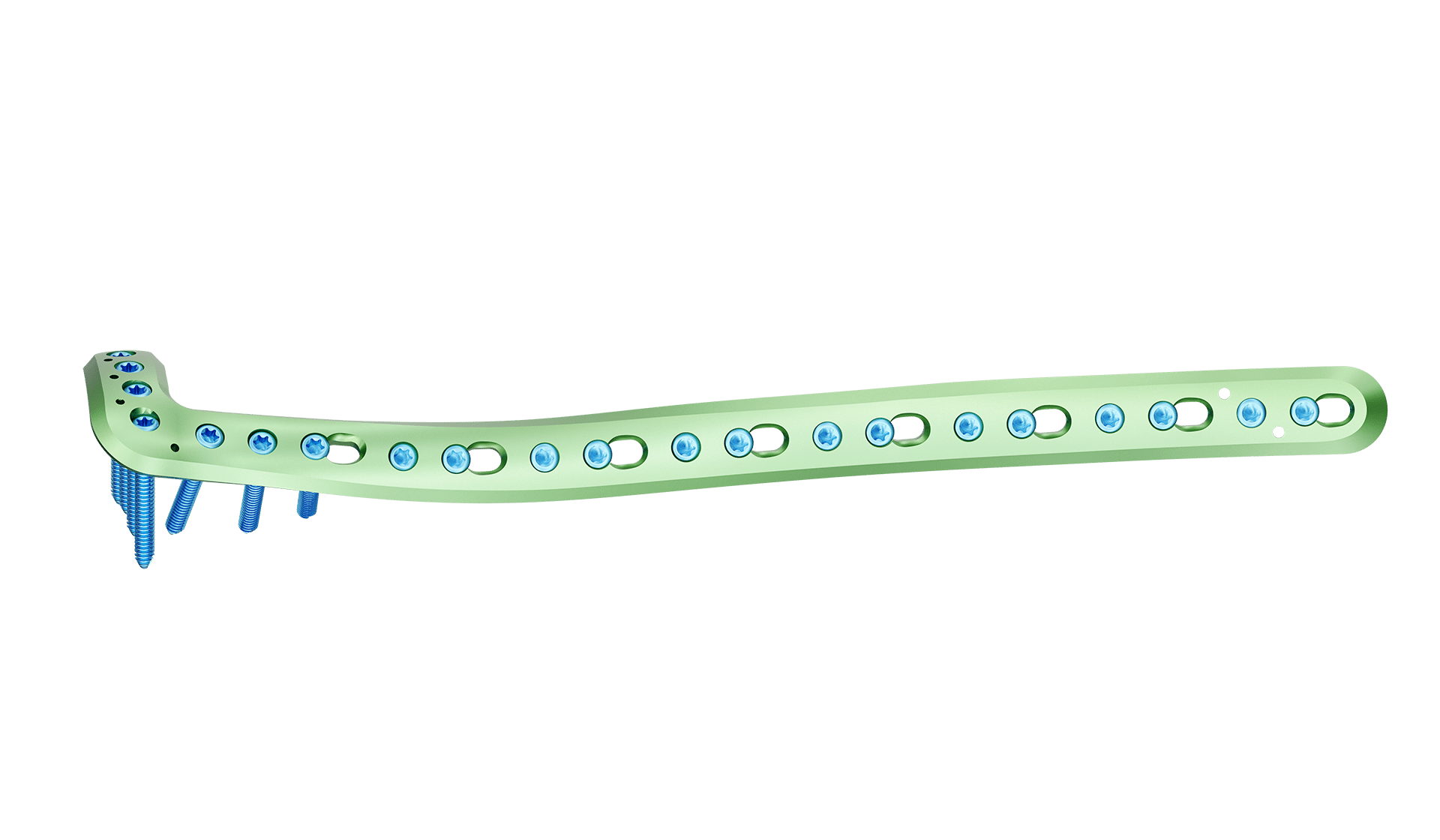 Distal Tibia Anterolateral Anatomik Plak