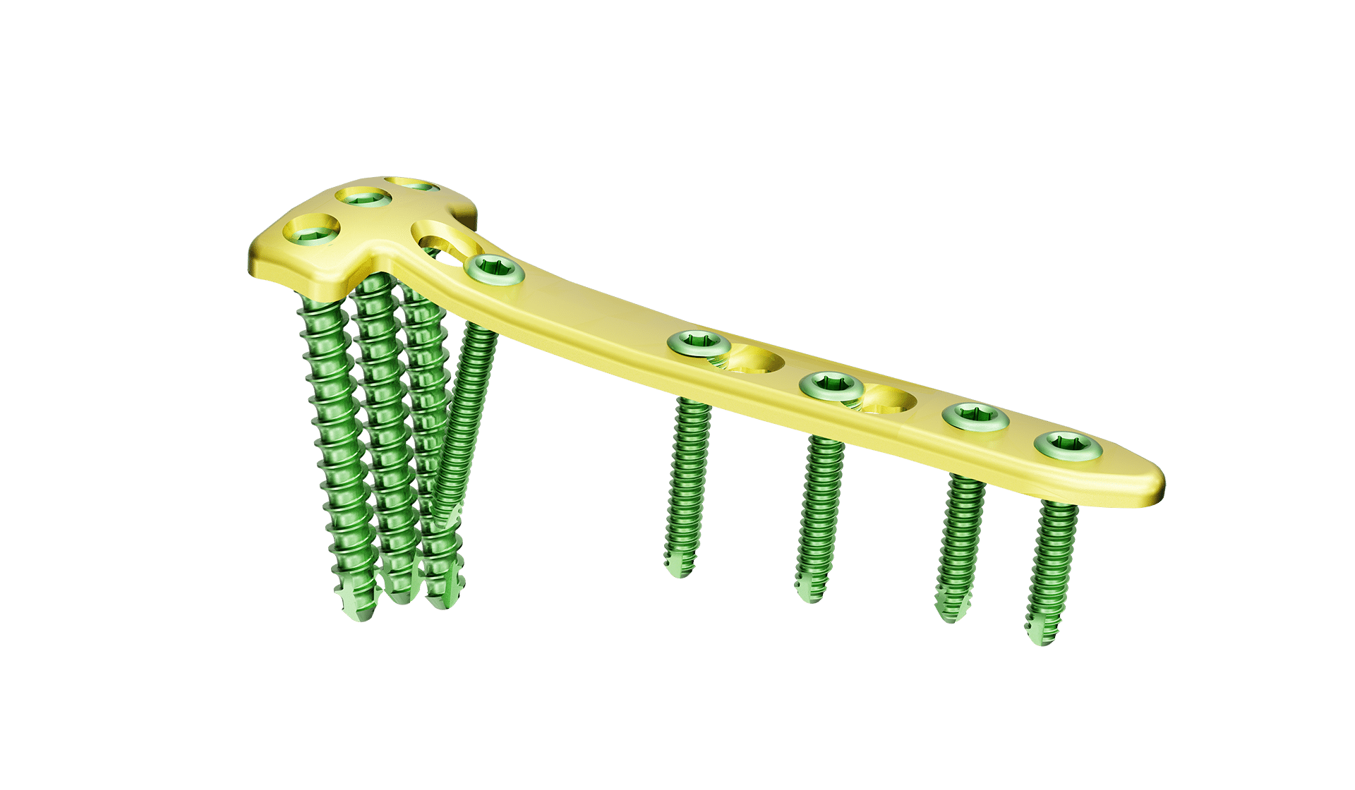 Proksimal Tibia Yüksek Osteotomi Plak